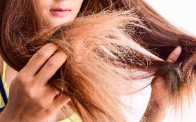 How to prevent hair fall. Dry Hair Woes Why How You Can Fix It Skinkraft