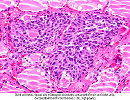 In teleost and avian species these cells occupy a structure outside the thyroid gland named the ultimobranchial body. Pathology Outlines Solid Cell Nests Ultimobranchial Body Remnants