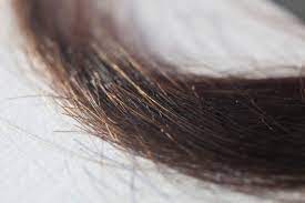 Sources after last use, cocaine or its metabolites typically can show up on a blood or saliva test for up to 2 days, a urine test for up to 3 days, and a hair test for months to years. Hair Testing For Drug Use Gathers Steam But Worries Of Bias Remain