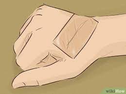 To further understand acne scars, let's zoom in on the process of how acne is formed and healed. How To Heal Scars Fast 9 Steps With Pictures Wikihow