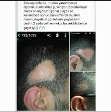 Lr Muzicelerine Bir Yenisini Daha Ekledi Sac Kiran Sakal Kiran Sorun Olmakdan Cikiyor