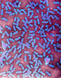 Image result for Alfalfa mosaic virus