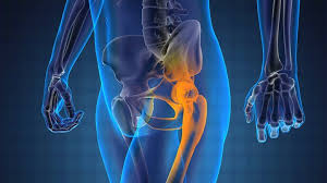 A sudden, noticeable new pain is the most common symptom of cancer that has spread to the bone. Faqs About Prostate Cancer That Has Spread To The Bones Everyday Health