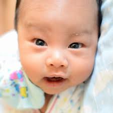 Image result for yellow scabs on the face in children