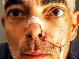 Fundraiser for James Lambert by Hannes Gehring : Calling the ultra  Community to support Frenchy