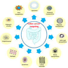 Metastatic colon cancer might cause symptoms in your liver, lungs, bones or abdomen. Nanoparticles And Colon Cancer Sciencedirect