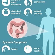 Health history affects the risk of developing rectal cancer. Colon Cancer Signs Symptoms And Complications