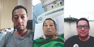 Kan kanseri, günümüzde tedavisi mümkün olmayan kanser türlerinden biridir. Pernah Hidap Kanser Tahap 4 Kini Makin Sihat Ustaz Hanafi Kongsi Tip Pemakanan Untuk Pesakit Kanser Vanilla Kismis
