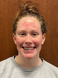 Pfaff's Record-Setting Night Highlights Class 3 Championships