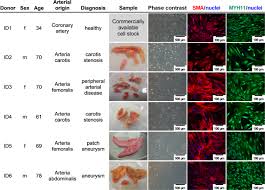 Muscle, contractile tissue found in animals, the function of which is to produce motion. Induced Osteogenic Differentiation Of Human Smooth Muscle Cells As A Model Of Vascular Calcification Scientific Reports
