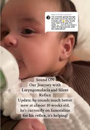 Gio's Journey with Laryngomalacia and Silent Reflux Update