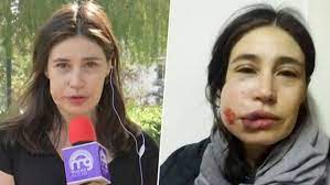 Bienvenida a nuestra sala/locutorio clotario blest de la confederación general de trabajadores (cgt chile) a la actriz maría paz grandjean. Actriz Maria Paz Grandjean Tras Recibir Balin En Su Rostro Me Dispararon Directo A La Cara Meganoticias