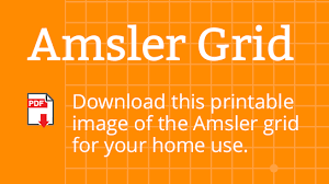 handy amsler grid printable suzannes blog