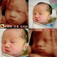 💗 We welcome to the outside...