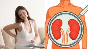 Aorta perut yakni pembuluh darah yang membawa darah dari jantung ke perut. Sakit Punggung Bisa Jadi Tanda Penyakit Ginjal Kenali Dan Pelajari Cara Mencegahnya Semua Halaman Grid Health