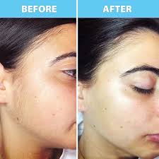 skin ™ Peach Fuzz Hair Cream