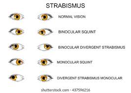 Image result for artistic divergence eyeballs