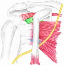 Weakening or defects of the conjoint tendon can trigger direct inguinal hernia. Https Journals Sagepub Com Doi Pdf 10 1177 2325967118795404