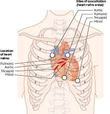 Regular rhythm, soft systolic murmur, no added sounds (auscultation of heart) forceful apical beat (palpation of the heart) normal carotid upstrokes (palpation of carotid) 2+ femoral and radial pulses (examination of peripheral arteries) 1+ bilateral pitting edema (exam of periphery cardiovascular) How To Auscultate For Heart Sounds In Adults