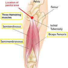 The most overly used, under trained muscles in the body. Blog Healing Hamstrings Attachment Injuries In Yoga