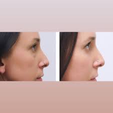 TOP 10 BEST Laser Skin Resurfacing in Huntsville, AL