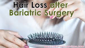 For a country obsessed with losing weight, spending more than work with a professional. Hair Loss After Weight Loss Surgery