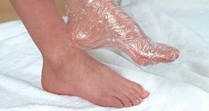 как избавиться от трещин на пятках с помощью глицерина Treshiny Na Pyatkah Samoe Interesnoe V Blogah