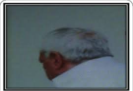 39 видео 932 просмотра обновлено 3 дня назад. Photograph Indicates More Than 90 White Hairs In Subject Mr A Before Download Scientific Diagram