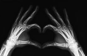 Xray Heart Radiologie Coeur Main Fond D Ecran Telephone