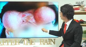한예슬 측 의료사고 맞고 현재 치료 중. í•œì˜ˆìŠ¬ ì˜ë£Œì‚¬ê³  í¬ë§ì€ ìžˆë‹¤ í™í˜œê±¸ ìƒíƒœ ì‹¬ê° ë'ê°€ì§€ ì¹˜ë£Œë²• æœ‰ ë‰´ìŠ¤ ë™ì•„ë‹·ì»´