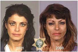 Methamphetamine (meth) is an addictive stimulant that strongly activates certain systems in the brain and speeds up the body's central nervous system. The Top 10 Worst Meth Transformations Addiction Center