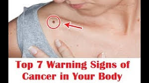 Here are 13 pancreatic cancer warning signs you need to know. Top 7 Warnings Signs Of Cancer In Your Body Early Symptoms Of Cancer Detection Youtube