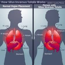 In the following article, we take a look at the important internal organs of the human body and their functions in the bigger biological system. Why Are Some People Born With A Reversal Of Organs Howstuffworks