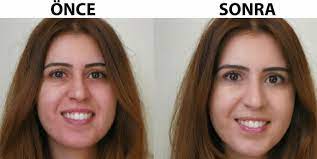 Çok yüksek sıcaklıklarda saklamamanız da tavsiye edilir. Arap Kizi Kremi Nasil Bir Seydir Fiyati Nedir Kullananlar Ne Diyor Kombin Kadin