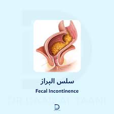 Image result for Fecal Incontinence