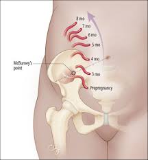 And it is not only challenging because you need to sit for hours on the pot but also because it sitting and worrying or over thinking can make the situation worse. Abdominal Pain In Early Pregnancy Psnet