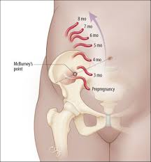Check spelling or type a new query. Abdominal Pain In Early Pregnancy Psnet