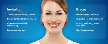 The invisalign treatment process involves the wearing of a series of transparent, removable aligners that are made to fit over your teeth in a practically the advantages of getting your teeth straightened. Straight Teeth Without The Sacrifices Cornelia Dental