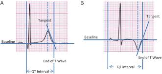 Image result for T Wave