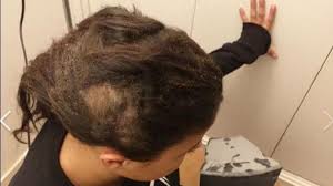 Une information relayée par le site koaci.com. Une Adolescente Se Fait Bruler Les Cheveux Ses Agresseuses Diffusent La Video Sur Snapchat