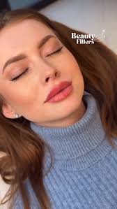 Aumento de menton, marcaje mandibular y perfilado 🙌🏻 Logramos este  increíble resultado con 3 Jeringas de Ácido Hialurónico ✨💉 Paquetes para  este servicio con 3 Jeringas: Marca Starfill $9,999 Lo sugerido para