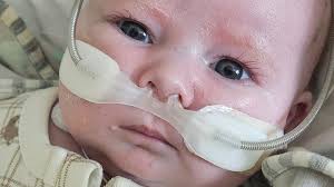 Fundraiser by Angie Johnstone : Xaviers story