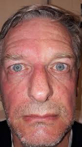 Image result for Harlequin Color Change