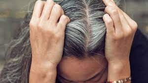 The reason of white hair in young age is the less production of melanin due to stress. 15 Simple Ways To Get Rid Of White Hair At A Young Age Youtube