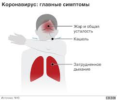 Симптомы в зависимости от штамма. Chto Takoe Koronavirus A Lokdaun Kak Dolgo Dlitsya Bolezn Obyasnyaem Vse Pro Covid 19 Bbc News Russkaya Sluzhba