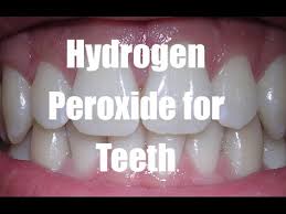 2021's top teeth whitener · 10,000 reviews Hydrogen Peroxide For Teeth Teeth Whitening Tips Youtube