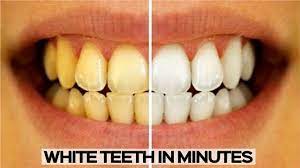 Maybe you would like to learn more about one of these? How To Whiten Your Teeth Easy And Quick Teeth Whitening Youtube