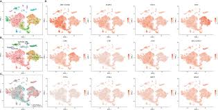 Dj anne v ibrahim malaysia hottest dj radio. Frontiers Identification Of Pro Fibrotic Macrophage Populations By Single Cell Transcriptomic Analysis In West Highland White Terriers Affected With Canine Idiopathic Pulmonary Fibrosis Immunology