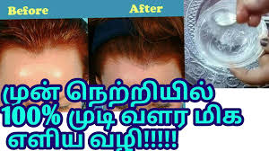 There are loads of basic hair growth tips. à®® à®© à®¨ à®± à®± à®¯ à®² à®® à®Ÿ à®µà®³à®° à®® à®• à®Žà®³ à®¯ à®µà®´ Hair Growth Tips For Forehead In Tamil Youtube