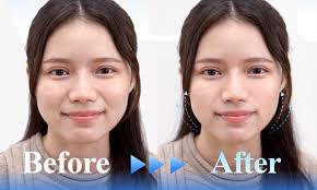 The Best Facials and Treatments to Get Your Skin Ready for Chinese New  Year, Including 1-for-1 Deals!